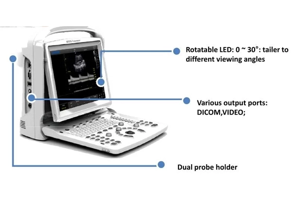 b ultrasound scanner